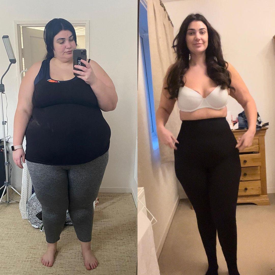 class="content__text"
 19 months post gastric bypass and - 14 stone! I can’t believe just how much my life has changed. I honestly can’t thank @streamlinesurgical enough. Guy Slater really did change my life. 

To anyone thinking about it, just do it! I promise you it’s worth it ❤️ 

 #gastricbypass #gastricsleeve #gastricsleeveuk #gastricbypasssurgery #gastricbypasssurgery #weightloss #weightlossjourney #weightlosstransformation #gastricsleevebeforeandafter #wls #wlsphotochallenge #wlsjourney #wlssupport #wlstransformation #extremeweightloss 
 