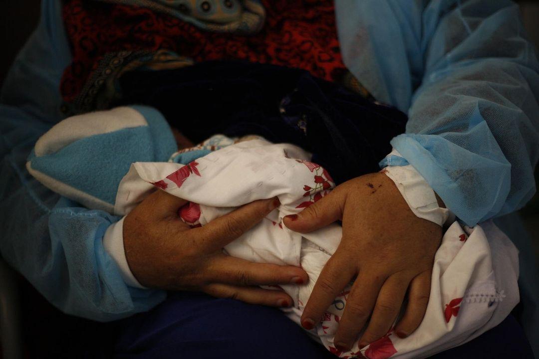 class="content__text"
 در این #روز زن، یونیسف زنگ خطر را به صدا در میاورد.

در افغانستان، بیش از 20 فیصد زنان باردار و شیرده دچار سوء تغذیه حاد هستند. 

بین سال های 2020 الی 2022، تعداد تخمینی زنان باردار و شیرده مبتلا به سوء تغذیه از 563000 به 835000 نفر افزایش یافته است. 
 
سرمایه گذاری در برنامه های تغذیه لازمی برای زنان و دختران نوجوان می تواند این روند را معکوس کند. 
 