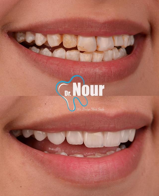 dr.nour.dentist